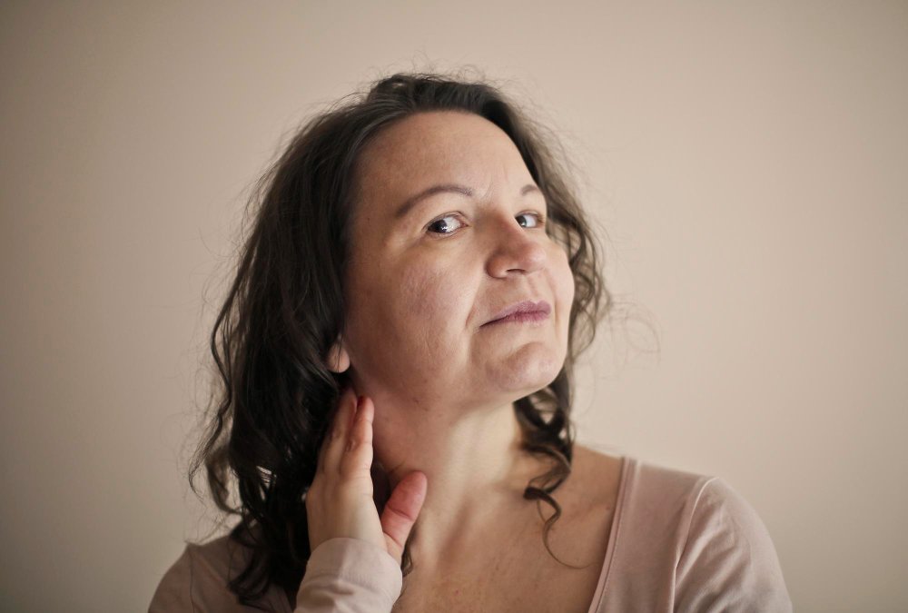 how to get rid of smile lines on face