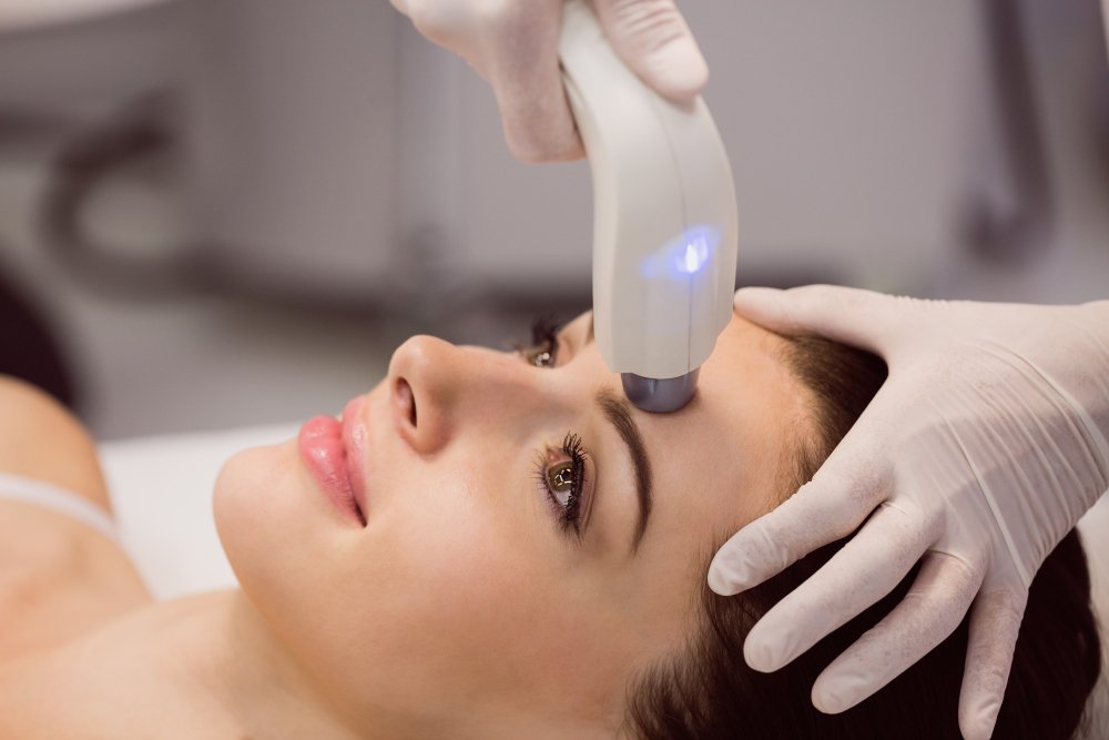 Laser Treatment for Skin Pigmentation