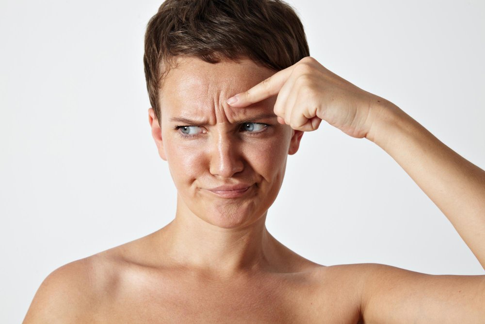 Why Am I Getting Forehead Wrinkles at 30?