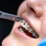 Aesthetic dental clinic Bangalore