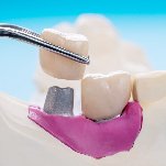 Dental clinic in Banashanri 