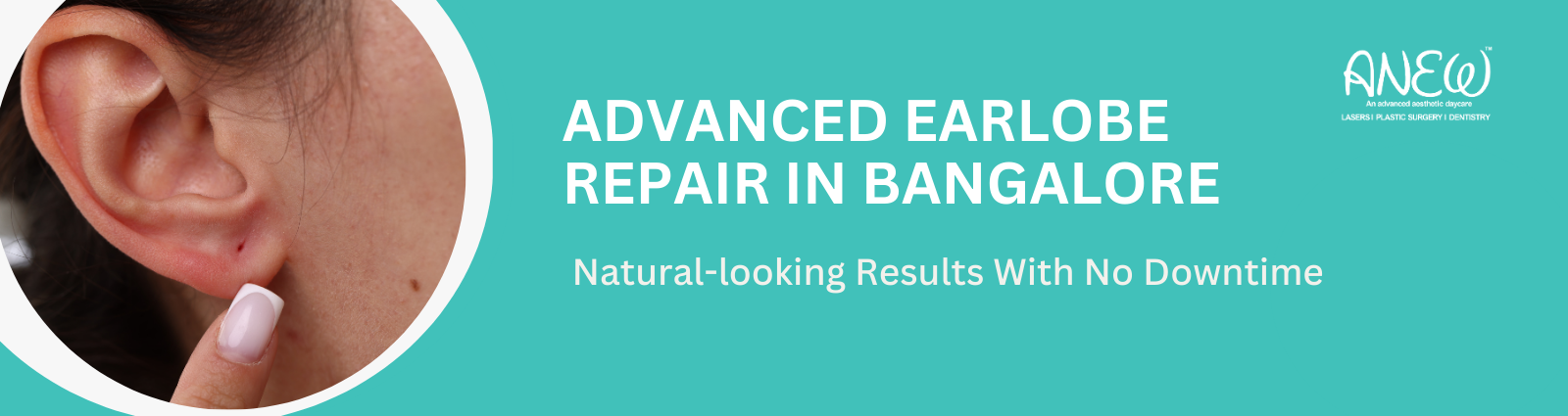 earlobe repair surgery in bangalore