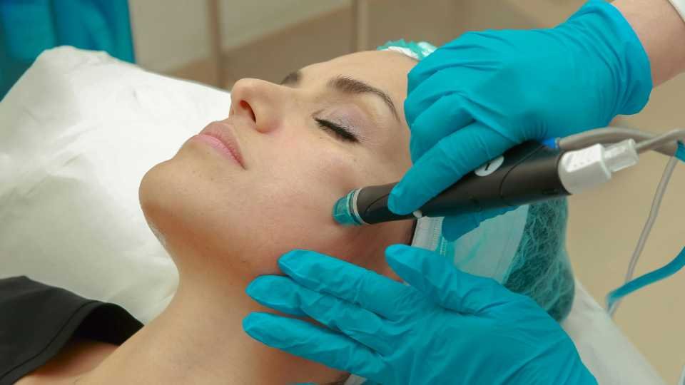 Laser treatment for skin