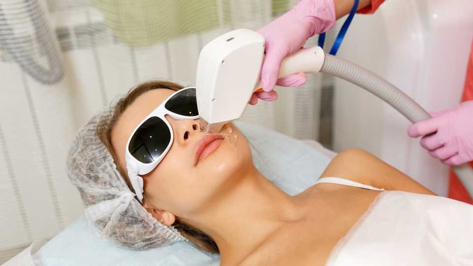 Laser treatment for skin