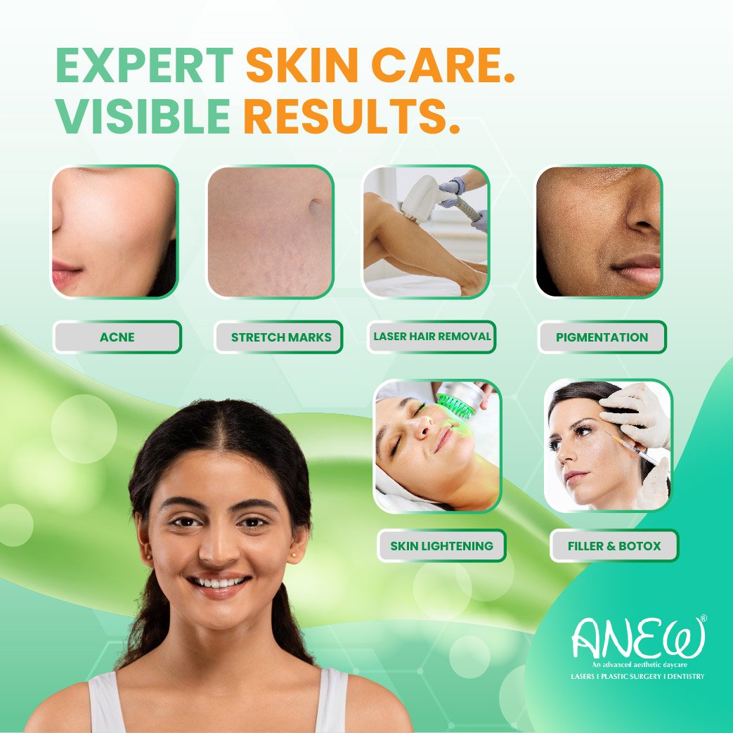 Skin clinic in Bangalore
