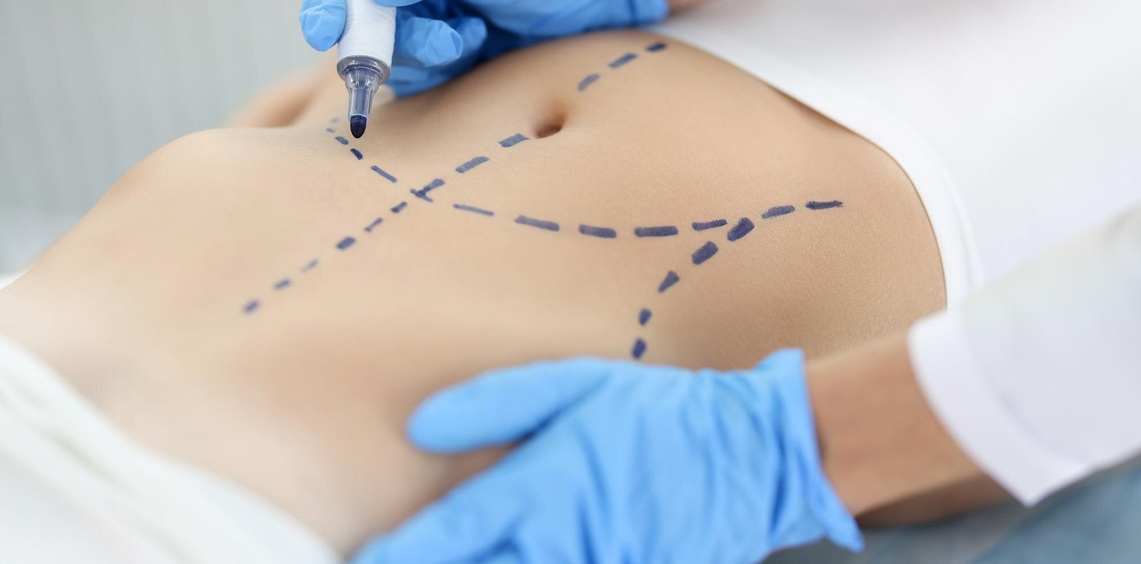 Plastic Surgery In Bangalore