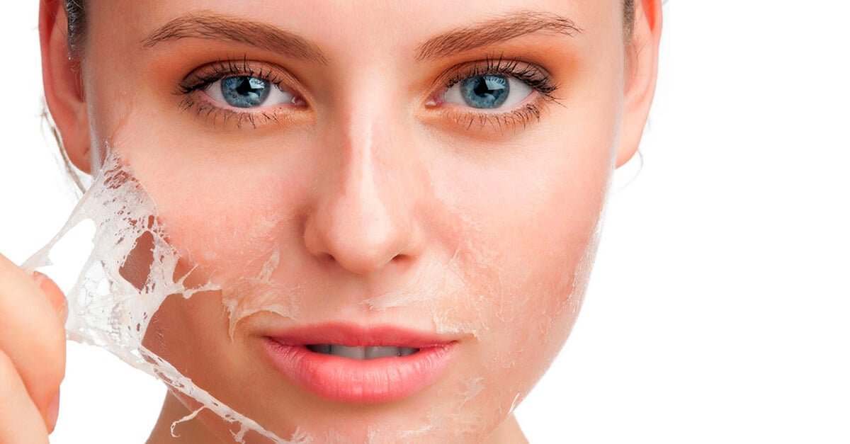 How to Prepare Your Skin Before a Chemical Peel