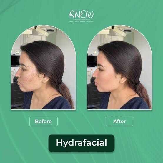 BEFORE AND AFTER IMAGE