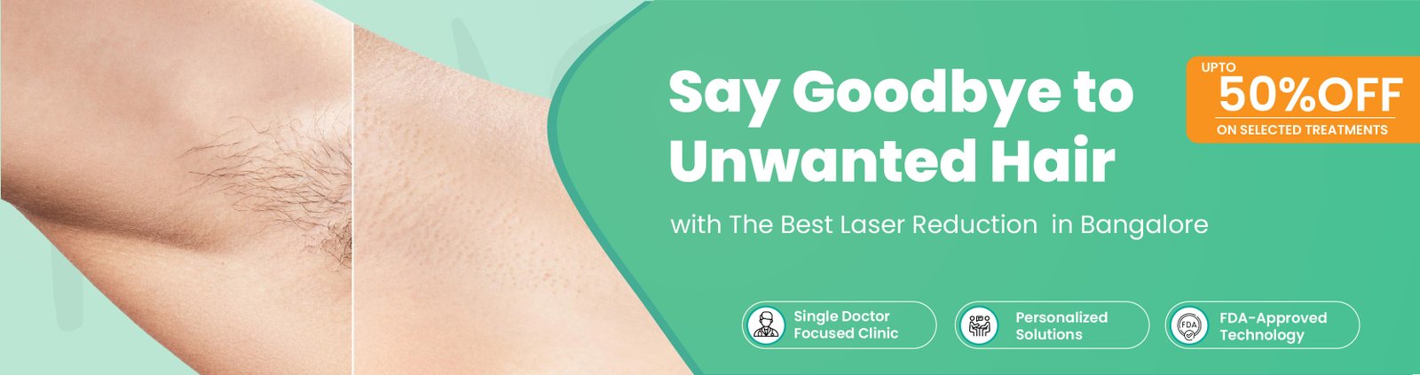 Laser Hair Reduction in Banashankari