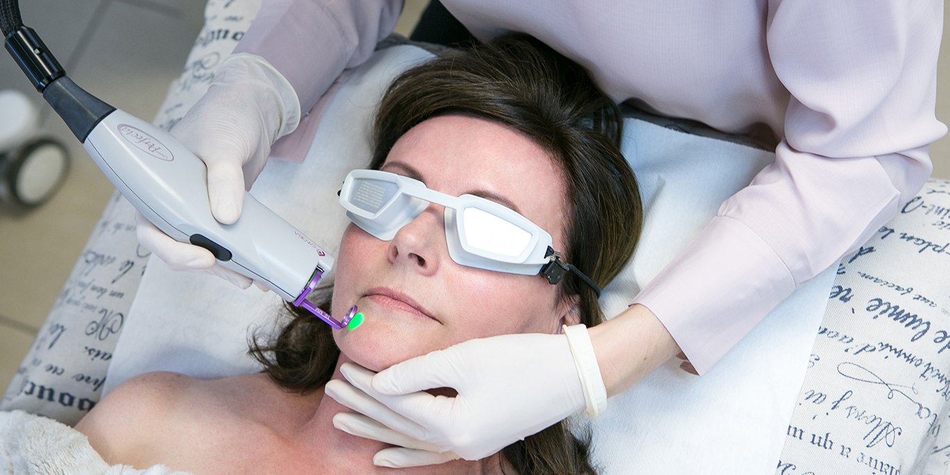Laser Treatment for Vascular lesions Bangalore