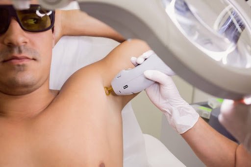 safe laser hair removal treatment