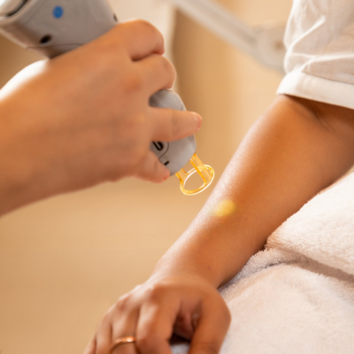 laser hair reduction in bangalore