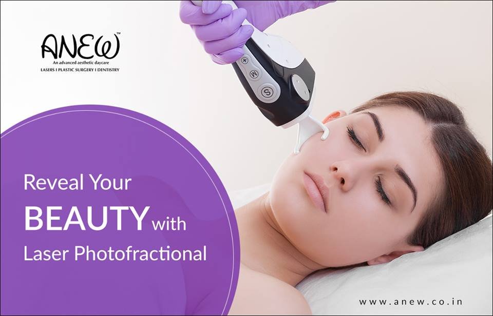 Laser Photofractional