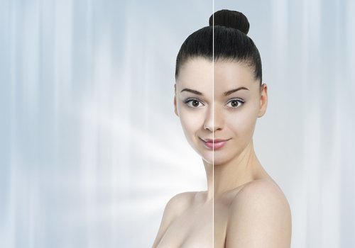 SKIN WHITENING Treatment in BANGALORE - ANEW