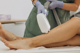 Long Pulsed Nd YAG Laser for port wine stains