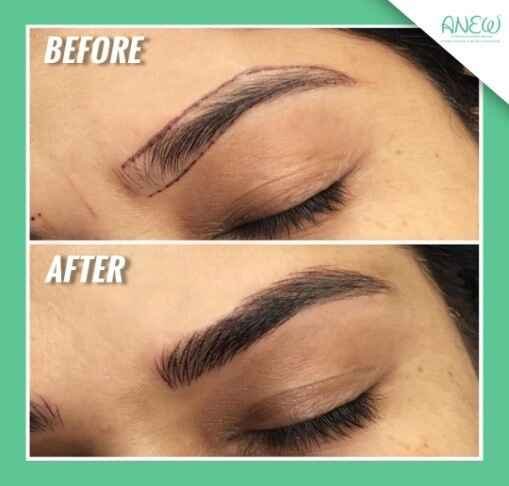Microblading - Aesthetic Day Care Centre in Bangalore