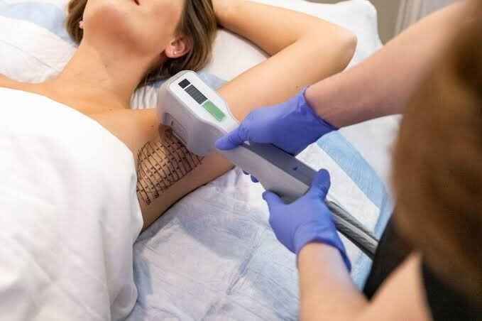 Stay Dry and Confident this Summer: The Miradry Miracle Treatment