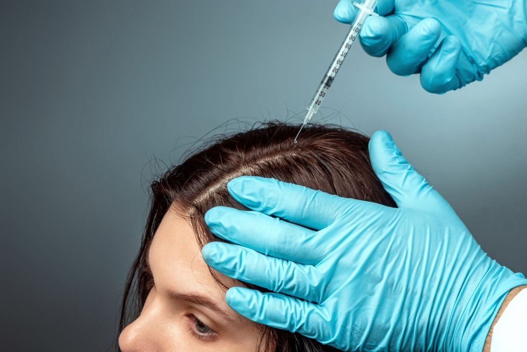 Stem Cell Therapy: The Latest Breakthrough in Hair Loss Treatment