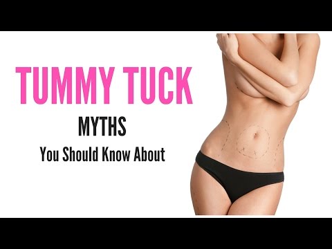 Tummy Tuck Myths
