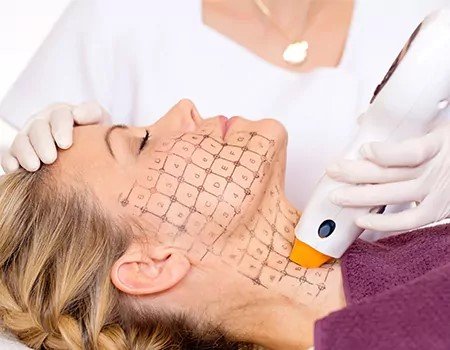 You know these top 5 treatments preferred by celebrities?