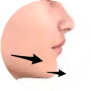 Nose & Chin Surgery in Maldives