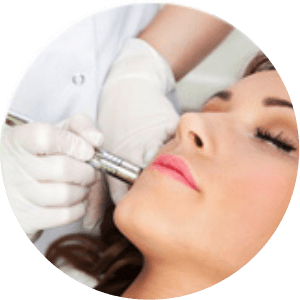 Laser Treatment for pimples and acne