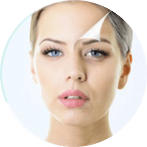 Non Ablative Laser Treatment for Skin Resurfacing